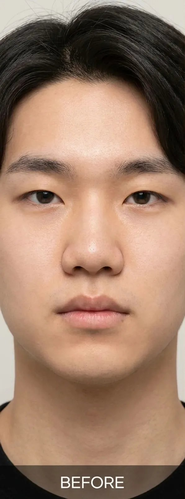코성형 — 전